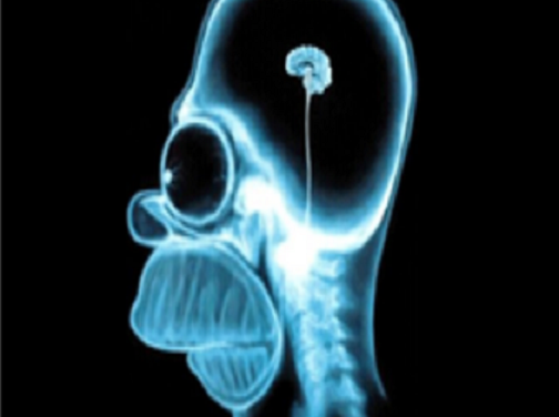 Do Zimbabweans think small when it comes to business?